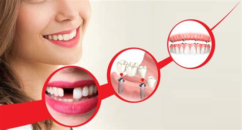 Spell Dental: The Key to Maintaining a Healthy Smile